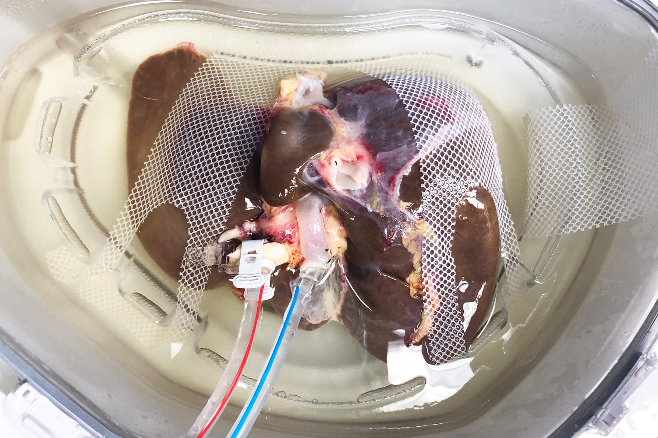 Liver on LifePort Liver Transporter