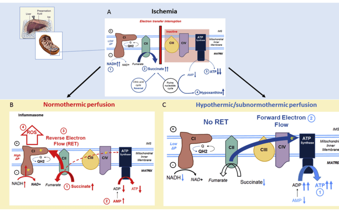 Evolving Trends in Machine Perfusion for Liver Transplantation
