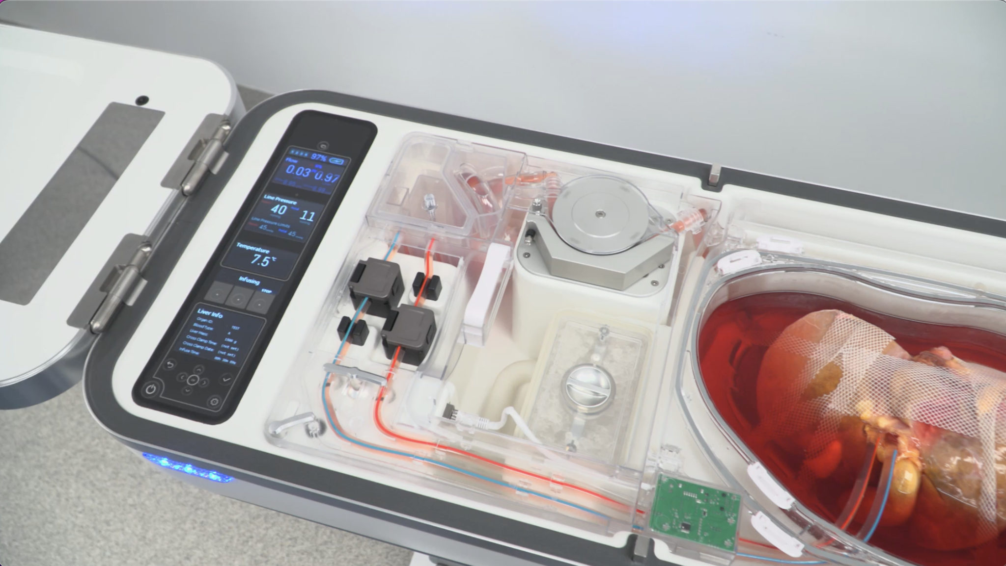 LifePort Liver Transporter