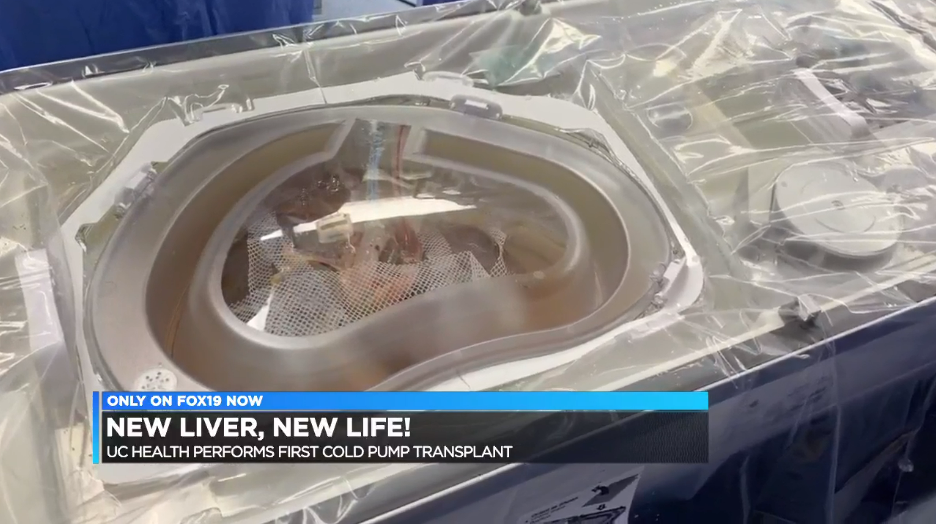 UC Health liver Transplant